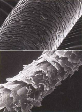 haircuticle under a microscope showing health or damage